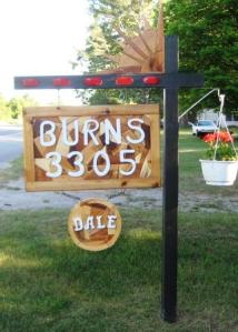 Burns sign Burns sign